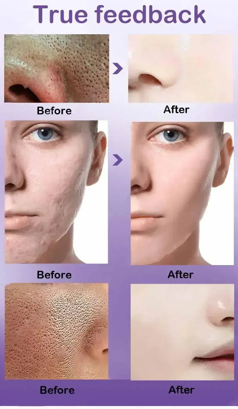Face Skin Pore Shrinkage Serum Long-Lasting Moisturizing Improves Large Pores Calming Skin Care Essence
