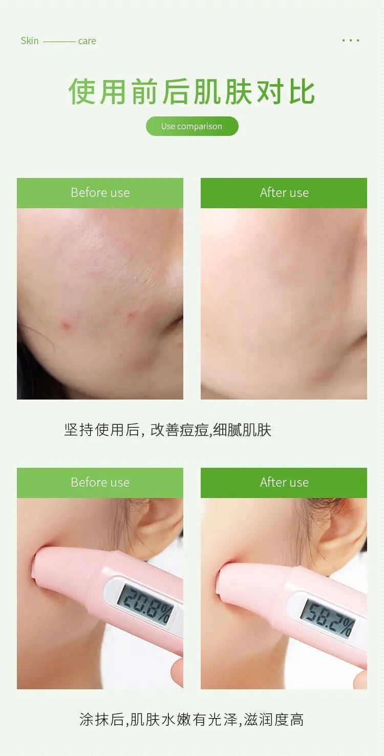 260ml aloe vera gel moisturizing and brightening skin tone acne-removing aloe vera gel after-sun gel moisturizing cream