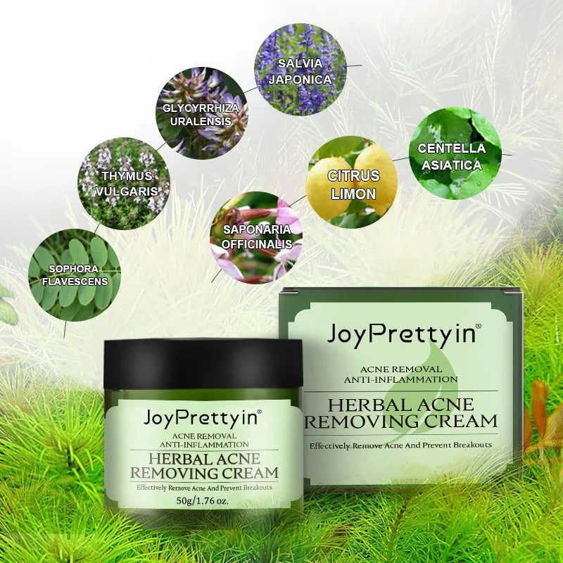 Herbal Acne Moving Cream Long Lasting Moisturizing Face Care Products Oil Control Fading Acne Scars Marks Skin Care Beauty