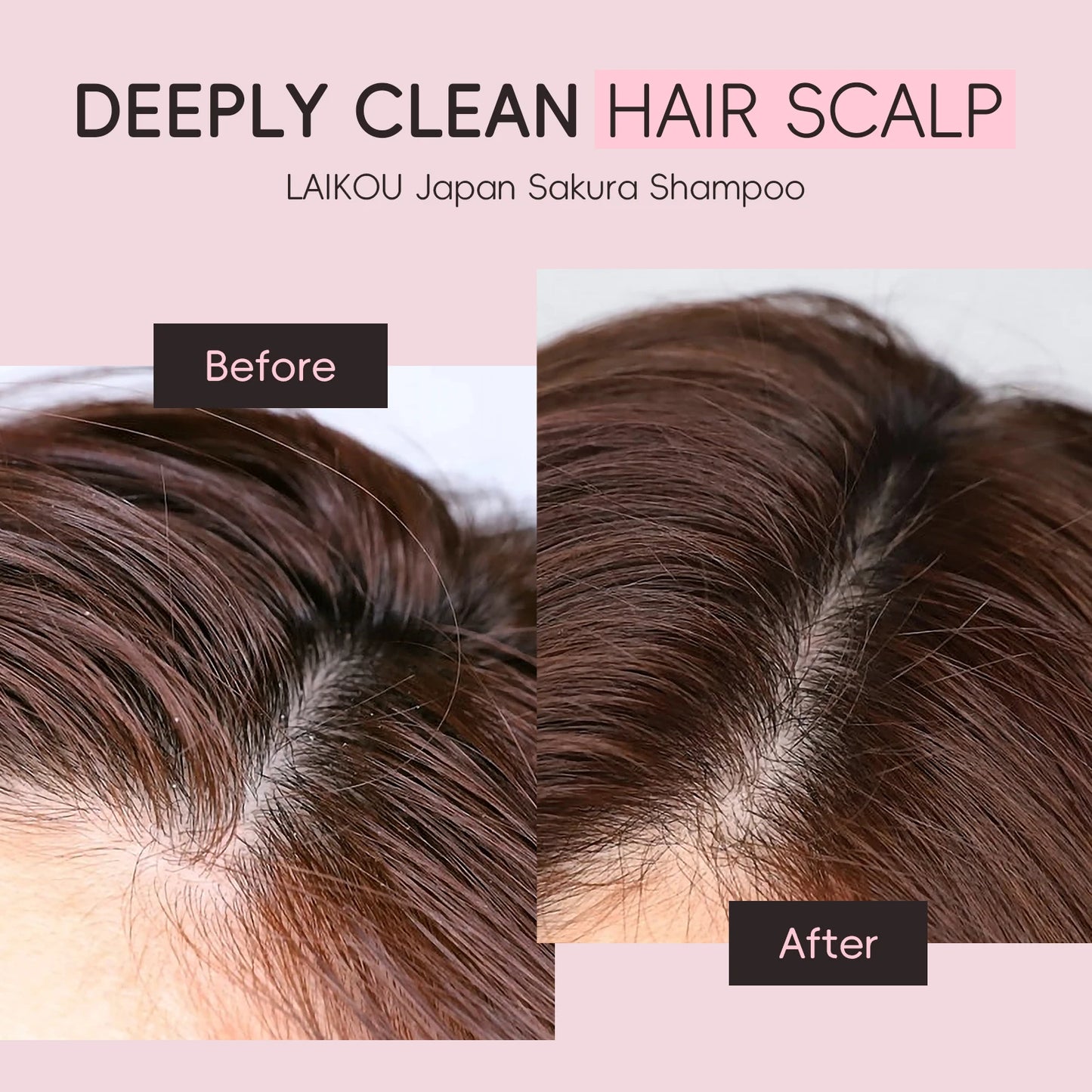 LAIKOU Sakura Shampoo Repair Anti Split Ends Smooth Frizz Dry Hair