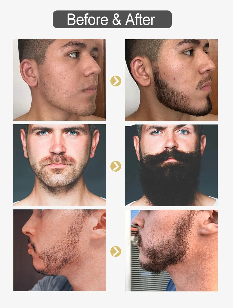 Natural Beard Care Essential Oil 30ml,Deeply Moisturizes Nourishes Beard,Smooth & Glossy for Men Fuller Thicker Styling Care