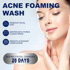 Facial Cleanser Anti Acne Oil Control Blackhead Remover Shrink Pores Deep Cleansing Acne Treatment Moisturizing Face Wash 100g