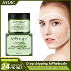 Herbal Acne Moving Cream Long Lasting Moisturizing Face Care Products Oil Control Fading Acne Scars Marks Skin Care Beauty