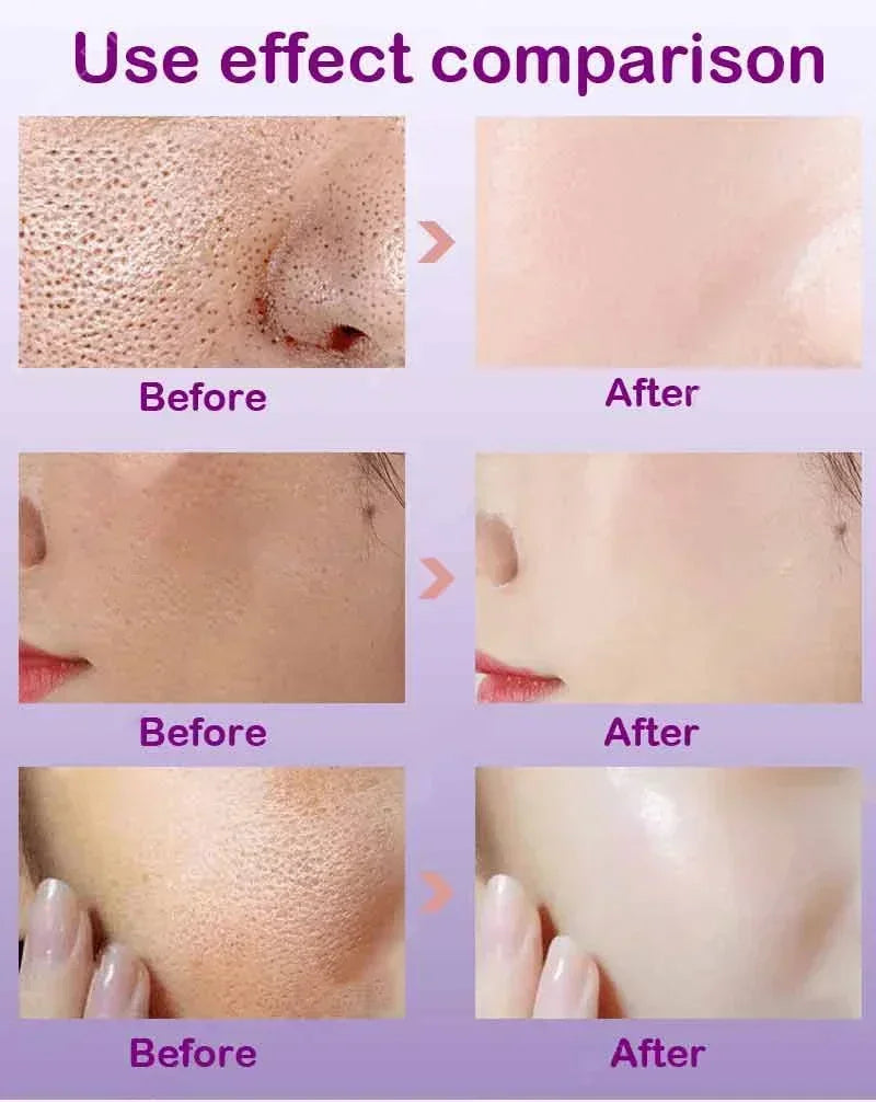 Face Skin Pore Shrinkage Serum Long-Lasting Moisturizing Improves Large Pores Calming Skin Care Essence
