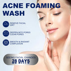 Facial Cleanser Anti Acne Oil Control Blackhead Remover Shrink Pores Deep Cleansing Acne Treatment Moisturizing Face Wash 100g