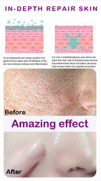 Face Skin Pore Shrinkage Serum Long-Lasting Moisturizing Improves Large Pores Calming Skin Care Essence