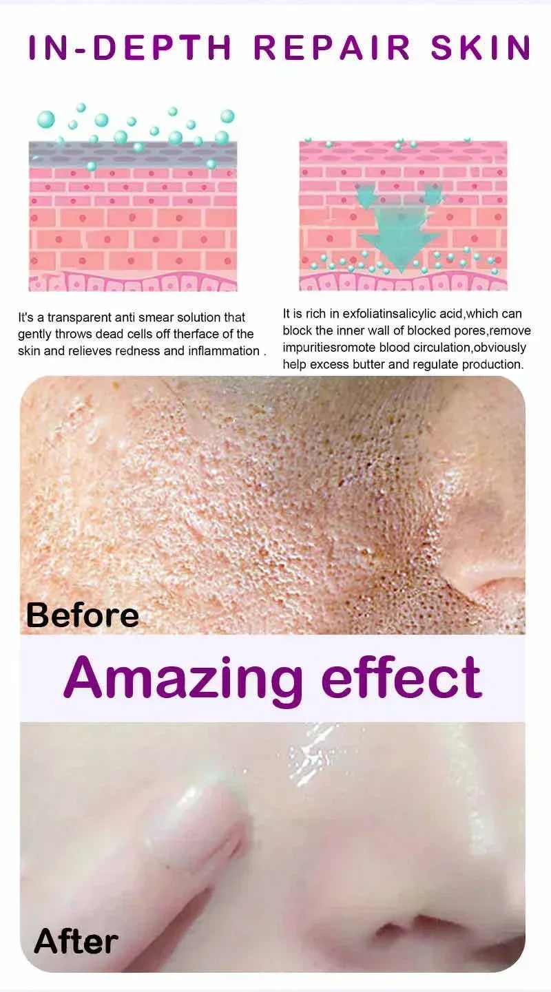 Face Skin Pore Shrinkage Serum Long-Lasting Moisturizing Improves Large Pores Calming Skin Care Essence