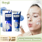 Facial Cleanser Anti Acne Oil Control Blackhead Remover Shrink Pores Deep Cleansing Acne Treatment Moisturizing Face Wash 100g