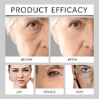 Brightening Hydrating Face Serum for Sensitive Skin 30ml Anti Aging Essence Reduces Dark Spots Acne Marks Lines Fast Absorbing