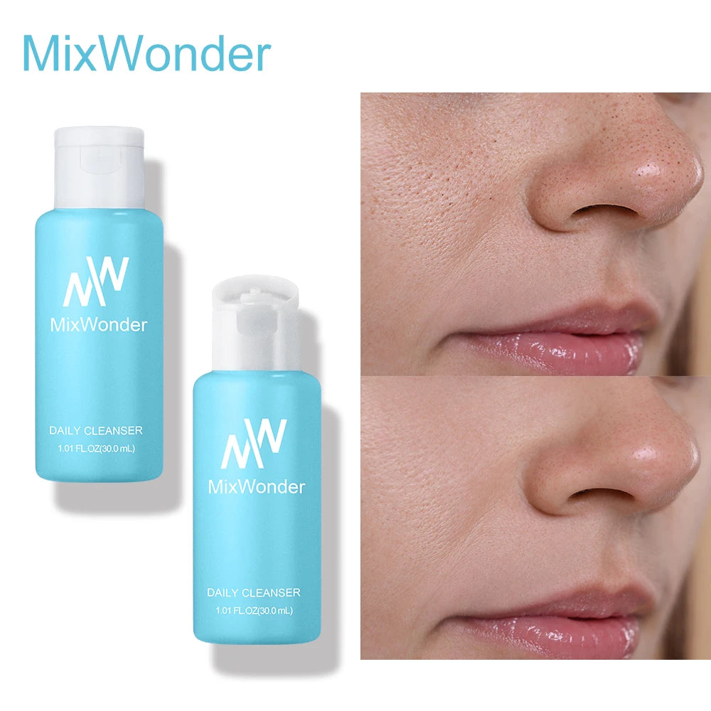 MixWonder Daily Cleanser - Hydrating, Deep Cleansing, Oil Control Face Wash for All Skin Types -Gentle & Non-Irritating Skincare