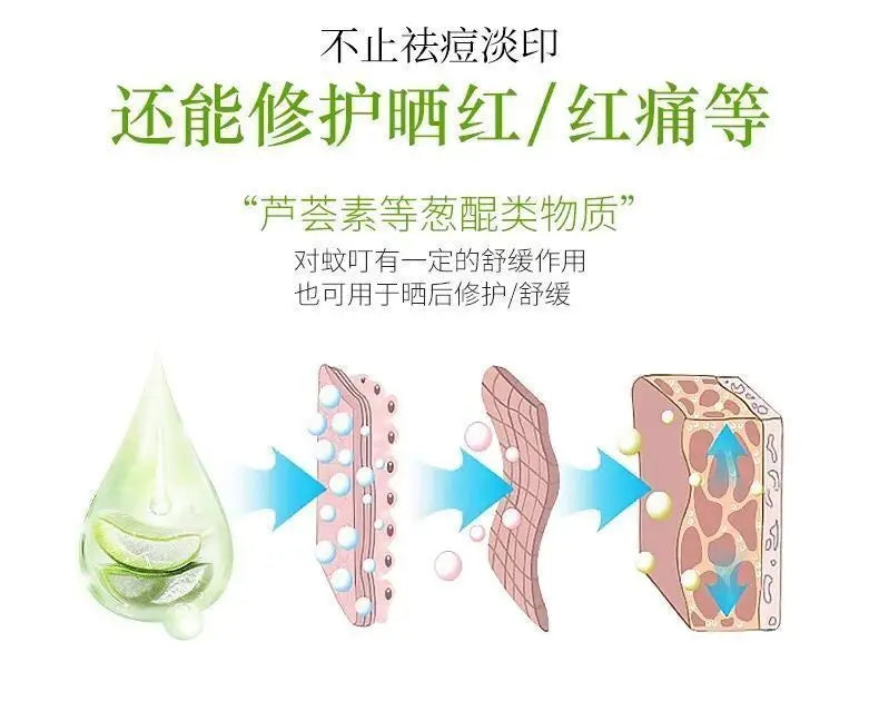 260ml aloe vera gel moisturizing and brightening skin tone acne-removing aloe vera gel after-sun gel moisturizing cream