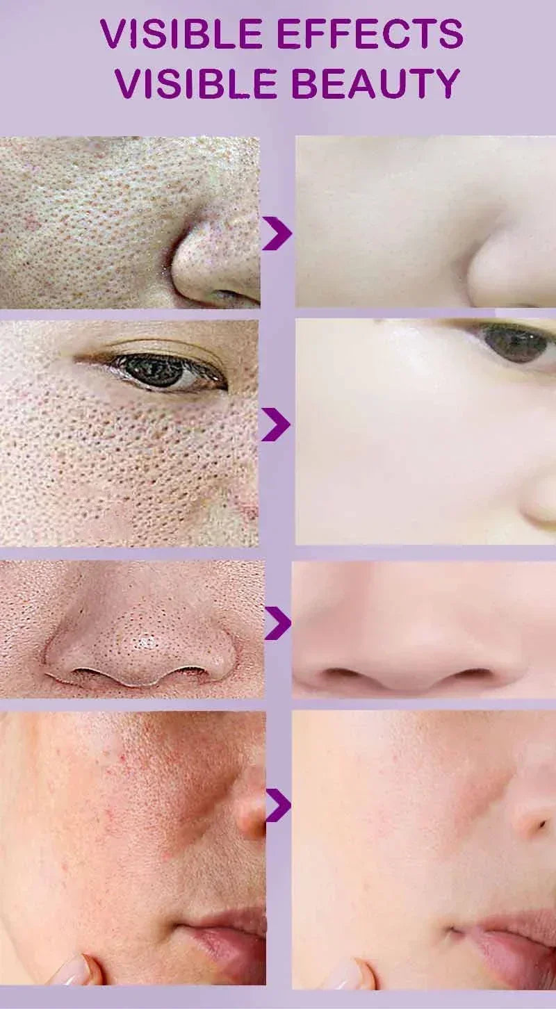 Face Skin Pore Shrinkage Serum Long-Lasting Moisturizing Improves Large Pores Calming Skin Care Essence