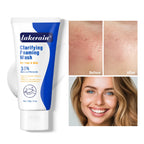 Acne Foaming Wash Deep Cleaning Unclogs Pores Prevents Breakouts for Face & Body Moisturizers Reduces Redness Skin Care