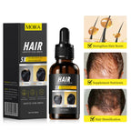 Hair Care Oil Hair Roots Scalp Treatment Improve Androgenetic Alopecia Scalp Treatment Serum Strengthen Hair Roots