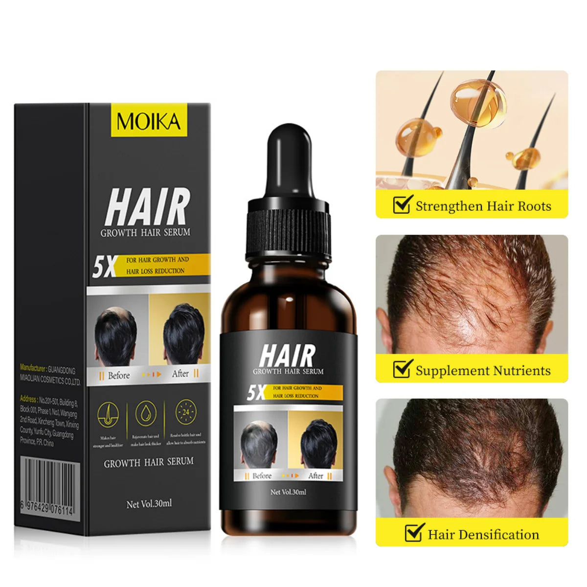 Hair Care Oil Hair Roots Scalp Treatment Improve Androgenetic Alopecia Scalp Treatment Serum Strengthen Hair Roots