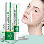 Herbal Acne Treatment Cream Face Scar Blackhead Remover Repair Gel Oil Control Shrink Pores Whitening Skin Care Korean Cosmetics