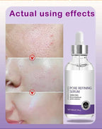 Face Skin Pore Shrinkage Serum Long-Lasting Moisturizing Improves Large Pores Calming Skin Care Essence