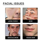 Men's Daily Face Wash Deep Cleansing Pore Oil Control Remove Acne Blackhead Brightening Facial Cleanser for Refreshed Skin