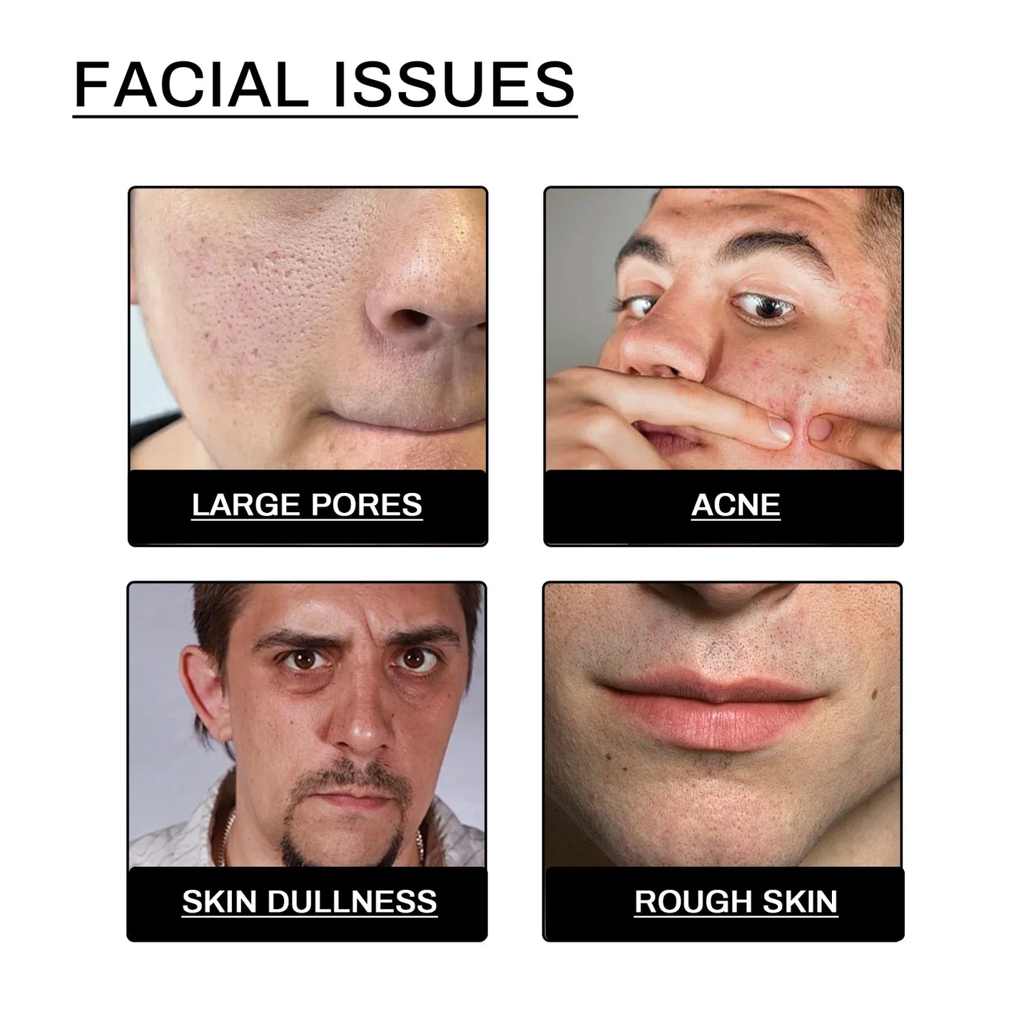 Men's Daily Face Wash Deep Cleansing Pore Oil Control Remove Acne Blackhead Brightening Facial Cleanser for Refreshed Skin