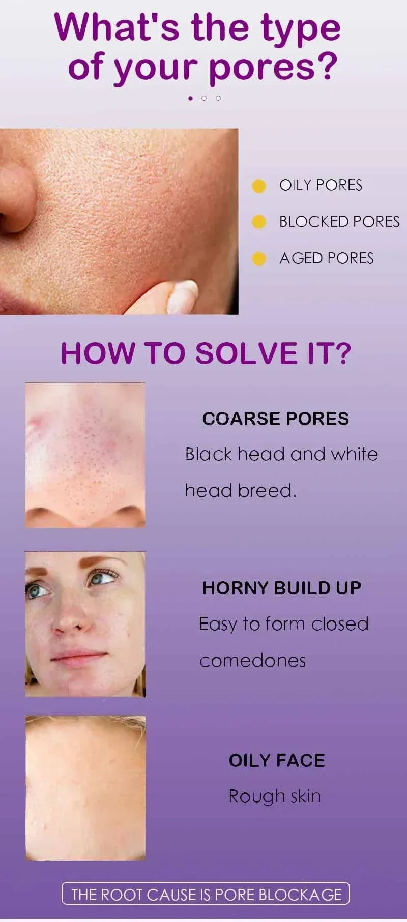 Face Skin Pore Shrinkage Serum Long-Lasting Moisturizing Improves Large Pores Calming Skin Care Essence