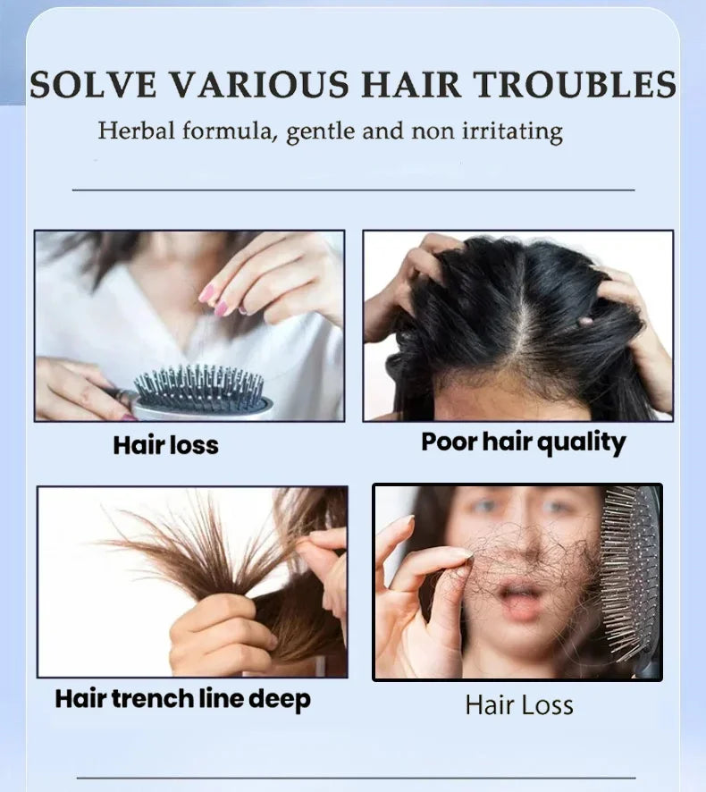 hair growth Serum Anti hair loss For seborrheic alopecia hereditary middle-aged Nourish Shiny Healthy hair Care essential oil