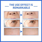 Anti Aging Serum Whitening Firming Fade Fine Lines Hydrating Facial Serum Reduces Wrinkles Skin Repair Nourishing For Skin Care