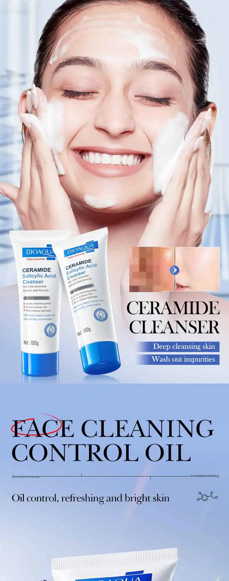 Salicylic Acid Cleansing Facial Cleanser Oil Control Anti-Acne Skin Care Whitening Cleanser Gentle Mild Facial Cleanser
